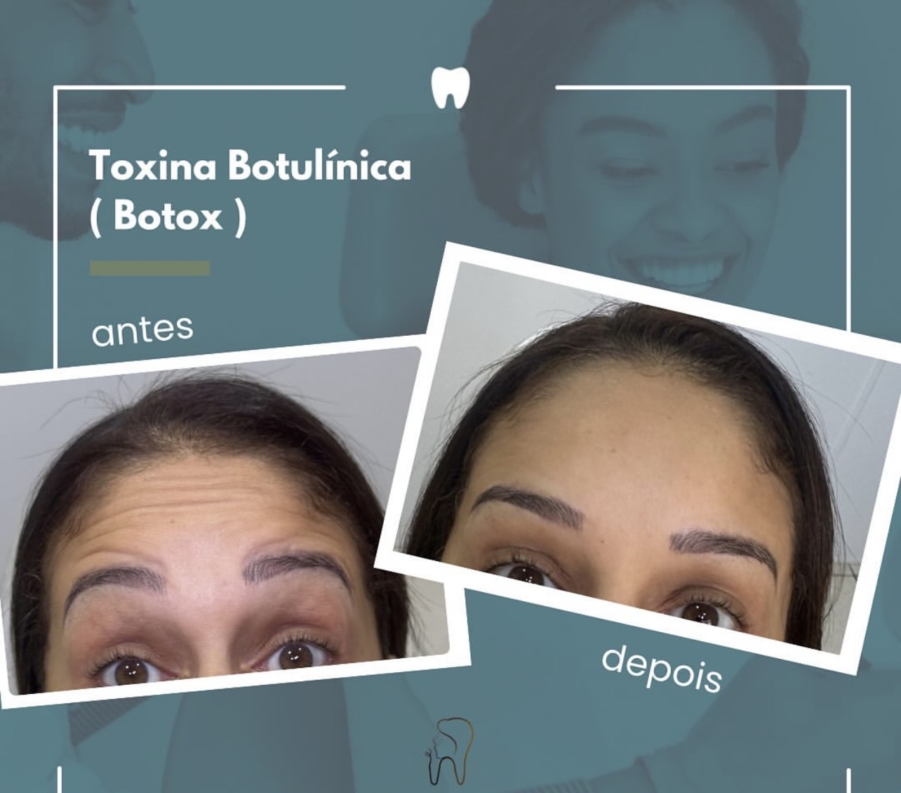 Resultado de transformação dental 6